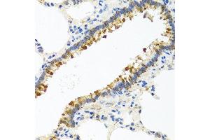 Immunohistochemistry of paraffin-embedded rat lung using CST4 antibody at dilution of 1:100 (40x lens). (CST4 抗体)