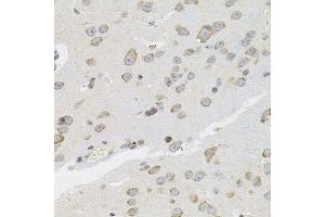 Immunohistochemistry of paraffin-embedded mouse brain using VEPH1 antibody. (VEPH1 抗体  (AA 448-547))