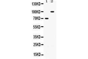 Western blot analysis of ZP1 expression in rat ovary extract ( Lane 1) and SKOV3 whole cell lysates ( Lane 2). (ZP1 抗体  (N-Term))