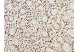Immunohistochemistry of paraffin-embedded human colon tissue using ABIN7142431 at dilution of 1:100 (MRPL49 抗体  (AA 1-166))