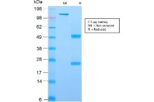 SDS-PAGE Analysis Purified YBX1 Mouse Recombinant Monoclonal Antibody (rYBX1/2430). (Recombinant YBX1 抗体)