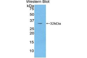 Western blot analysis of recombinant Human PAK4. (PAK4 抗体  (AA 299-542))