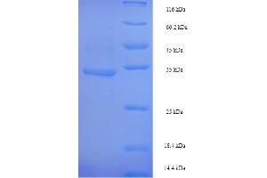 Crossover Junction Endodeoxyribonuclease RuvC (RuvC) (AA 2-173) protein (His-SUMO Tag)