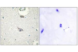 Immunohistochemistry analysis of paraffin-embedded human brain tissue using CADM4 antibody. (Cell Adhesion Molecule 4 抗体  (C-Term))