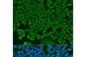 Immunofluorescence analysis of U2OS cells using HS1BP3 Polyclonal Antibody at dilution of 1:100. (HS1BP3 抗体)