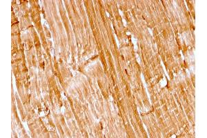 Formalin-fixed, paraffin-embedded human skeletal muscle stained with Myoglobin Recombinant Mouse Monoclonal Antibody (rMB/2105). (Recombinant Myoglobin 抗体)