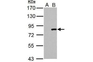WB Image Cullin 3 antibody detects Cullin 3 protein by Western blot analysis. (Cullin 3 抗体)