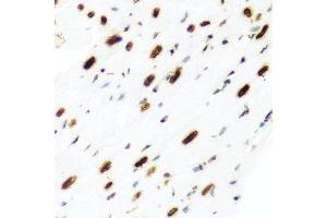 Immunohistochemistry of paraffin-embedded rat heart using H2AFX antibody (ABIN5997870) at dilution of 1/100 (40x lens). (H2AFX 抗体)