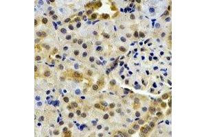 Immunohistochemical analysis of HPPDase staining in rat kidney formalin fixed paraffin embedded tissue section. (HPD 抗体)