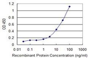 Detection limit for recombinant GST tagged CARTPT is 0. (CARTPT 抗体  (AA 1-116))