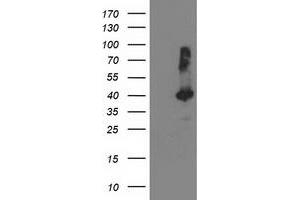 Western Blotting (WB) image for anti-TBC1 Domain Family, Member 21 (TBC1D21) antibody (ABIN1501318) (TBC1D21 抗体)