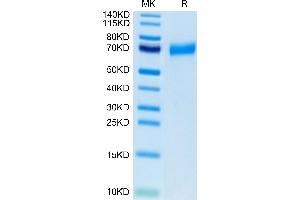 SDS-PAGE (SDS) image for C-Type Lectin Domain Family 12, Member A (CLEC12A) (AA 65-265) protein (Fc-Avi Tag,Biotin) (ABIN7274359)