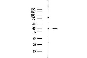 Western blot analysis of lysates from Hela cells(UV,30 min treatment), using KLF3 Antibody at 1/1000 dilution.