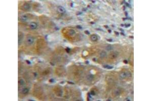 Used in DAB staining on fromalin fixed paraffin-embedded Liver tissue (CCL5 抗体  (AA 24-91))