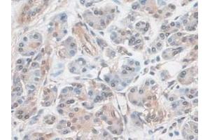 Detection of EZR in Human Pancreas Tissue using Polyclonal Antibody to Ezrin (EZR) (Ezrin 抗体  (AA 1-295))