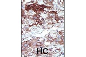 Immunohistochemistry (Paraffin-embedded Sections) (IHC (p)) image for anti-Phosphatidylethanolamine Binding Protein 1 (PEBP1) (AA 1-30), (N-Term) antibody (ABIN392674)