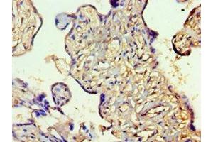 Immunohistochemistry (IHC) image for anti-Solute Carrier Family 27 (Fatty Acid Transporter), Member 4 (SLC27A4) (AA 494-643) antibody (ABIN7158496)