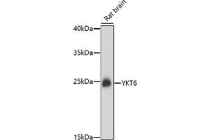 Western blot analysis of extracts of Rat brain using YKT6 Polyclonal Antibody at dilution of 1:1000. (YKT6 抗体)