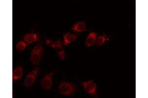Immunofluorescence (fixed cells) (IF/ICC) image for anti-Egf-Like Module Containing, Mucin-Like, Hormone Receptor-Like 3 (EMR3) (C-Term) antibody (ABIN6258148)
