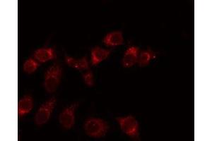 ABIN6275938 staining Hela by IF/ICC. (EMR3 抗体  (C-Term))
