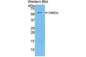 Western Blotting (WB) image for anti-ATPase, H+/K+ Exchanging, alpha Polypeptide (ATP4A) (AA 786-1014) antibody (ABIN7436267)