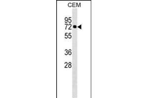 KLHL28 Antibody (C-term) (ABIN1537239 and ABIN2849863) western blot analysis in CEM cell line lysates (35 μg/lane). (KLHL28 抗体  (C-Term))