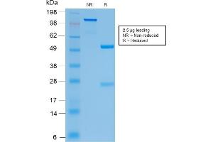 SDS-PAGE Analysis Purified CFTR Rabbit Recombinant Monoclonal Antibody (CFTR/2290R). (Recombinant CFTR 抗体)