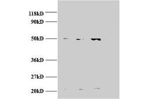 Western blot All lanes: AP2M1 antibody at 2 μg/mL Lane 1: Jurket whole cell lysate Lane 2: U87 whole cell lysate Lane 3: U251 whole cell lysate Secondary Goat polyclonal to rabbit IgG at 1/15000 dilution Predicted band size: 50 kDa Observed band size: 50, 22 kDa (AP2M1 抗体  (AA 1-435))