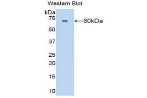 Western Blotting (WB) image for anti-Amylase 1, Salivary (AMY1) (AA 16-511) antibody (ABIN1857978) (Alpha-amylase 1 抗体  (AA 16-511))