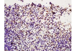 Formalin-fixed and paraffin embedded mouse spleen labeled with Rabbit Anti-PI 3 Kinase p110 delta (Tyr524) Polyclonal Antibody  at 1:200 followed by conjugation to the secondary antibody and DAB staining (PIK3CD 抗体  (pTyr524))