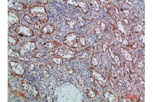 Immunohistochemical analysis of paraffin-embedded human-spleen, antibody was diluted at 1:200 (LTB 抗体  (AA 41-90))