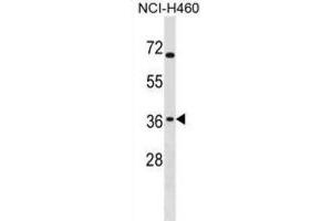 Western Blotting (WB) image for anti-ST6 (Alpha-N-Acetyl-Neuraminyl-2,3-beta-Galactosyl-1,3)-N-Acetylgalactosaminide alpha-2,6-Sialyltransferase 4 (ST6GALNAC4) antibody (ABIN3000613) (ST6GALNAC4 抗体)