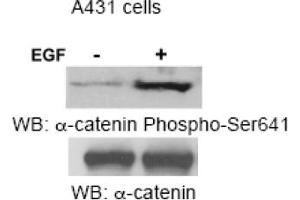 Image no. 1 for anti-Catenin (Cadherin-Associated Protein), alpha 1, 102kDa (CTNNA1) (Ser641) antibody (ABIN319361) (CTNNA1 抗体  (Ser641))