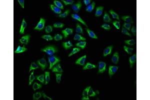 Immunofluorescence staining of Hela cells with ABIN7145154 at 1:66, counter-stained with DAPI. (CD72 抗体  (AA 150-208))