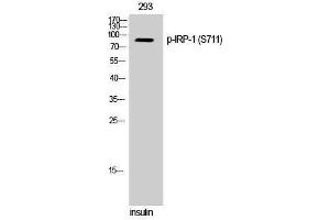 Western Blotting (WB) image for anti-Aconitase 1 (ACO1) (pSer711) antibody (ABIN3182636) (Aconitase 1 抗体  (pSer711))