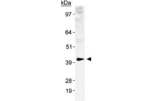 Western blot analysis of SLC2A1 in a human kidney membrane prep with SLC2A1 polyclonal antibody . (GLUT1 抗体  (AA 1-100))