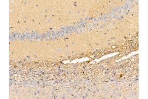 ABIN7094728 and ABIN7098779 at 1/100 staining Mouse brain tissue by IHC-P.