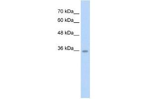 WB Suggested Anti-C6orf134 Antibody Titration:  2. (Chromosome 6 Open Reading Frame 134 (C6orf134) (N-Term) 抗体)