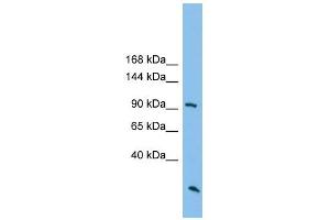 ARHGAP30 antibody used at 1 ug/ml to detect target protein. (ARHGAP30 抗体  (N-Term))