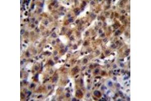 Immunohistochemistry analysis in human liver tissue (Formalin-fixed, Paraffin-embedded) using SPACA5B Antibody (N-term), followed by peroxidase conjugation of the secondary antibody and DAB staining. (SPACA5B 抗体  (N-Term))