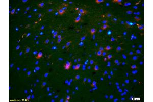 Formalin-fixed and paraffin-embedded rat brain labeled with Anti-OB/CDH11/OB-Cadherin Polyclonal Antibody, Unconjugated (ABIN1387539) 1:200, overnight at 4°C, The secondary antibody was Goat Anti-Rabbit IgG, Cy3 conjugated used at 1:200 dilution for 40 minutes at 37°C. (OB Cadherin 抗体  (AA 310-360))