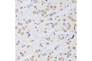 Immunohistochemistry of paraffin-embedded rat brain using PTRH2 antibody. (PTRH2 抗体  (AA 40-179))