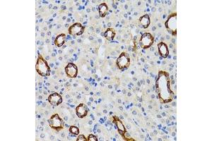 Immunohistochemistry of paraffin-embedded rat kidney using GABARAP antibody (ABIN6129966, ABIN6140874, ABIN6140877 and ABIN6221250) at dilution of 1:100 (40x lens). (GABARAP 抗体  (AA 1-117))