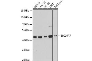 Western blot analysis of extracts of various cell lines, using SLC16 antibody (ABIN3017189, ABIN3017190, ABIN3017191 and ABIN6219987) at 1:3000 dilution. (SLC16A7 抗体  (C-Term))
