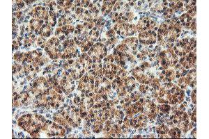 Image no. 1 for anti-1-Acylglycerol-3-Phosphate O-Acyltransferase 5 (Lysophosphatidic Acid Acyltransferase, Epsilon) (AGPAT5) antibody (ABIN1496498) (AGPAT5 抗体)