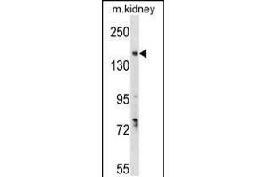 Western blot analysis in mouse kidney tissue lysates (35ug/lane). (GREB1 抗体  (AA 1417-1446))