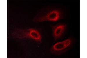 ABIN6267565 staining HeLa cells treated with PMA 125ng/ml 30' by ICC/IF. (14-3-3 zeta 抗体  (pSer58))