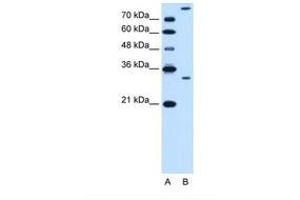 Image no. 1 for anti-Granzyme K (Granzyme 3, Tryptase II) (GZMK) (AA 78-127) antibody (ABIN6738148) (GZMK 抗体  (AA 78-127))