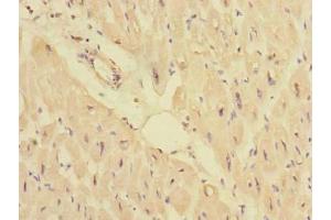 Immunohistochemistry of paraffin-embedded human heart tissue using ABIN7165964 at dilution of 1:100 (PPM1M 抗体  (AA 1-247))