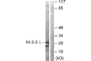 Western blot analysis of extracts from 293 cells treated with Forskolin (40nM, 30min) using 14-3-3 ζ (Ab-58) antibody (#B0001, Linand 2). (14-3-3 zeta 抗体  (Ser58))